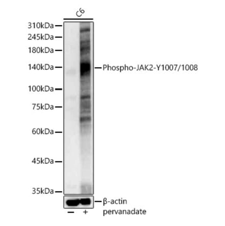 Western Blot - Anti-JAK2 (phospho Tyr1007 + Tyr1008) Antibody (A11009) - Antibodies.com