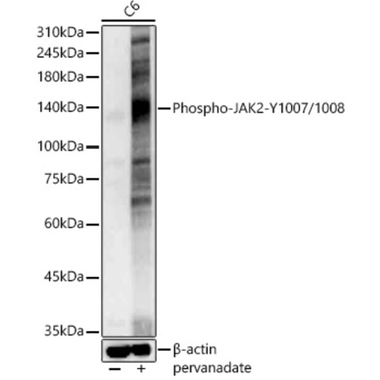 Western Blot - Anti-JAK2 (phospho Tyr1007 + Tyr1008) Antibody (A11009) - Antibodies.com
