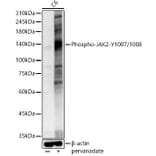 Western Blot - Anti-JAK2 (phospho Tyr1007 + Tyr1008) Antibody (A11009) - Antibodies.com