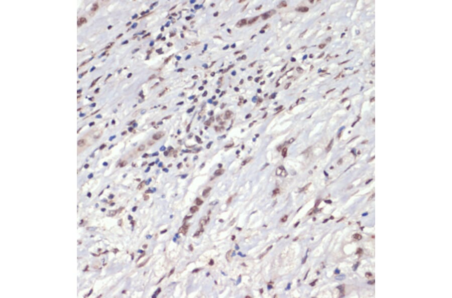 Immunohistochemistry - Anti-JAK2 (phospho Tyr1007 + Tyr1008) Antibody (A11009) - Antibodies.com