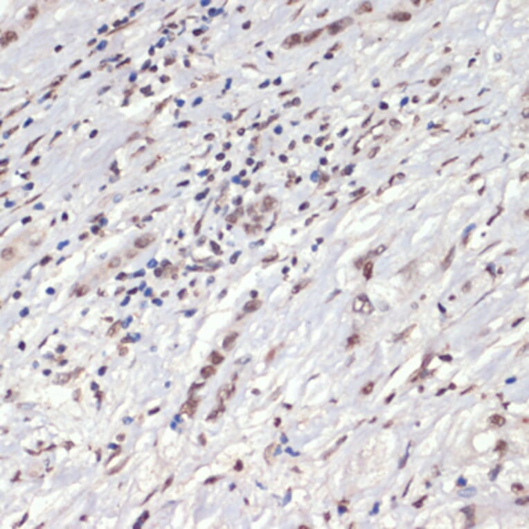 Immunohistochemistry - Anti-JAK2 (phospho Tyr1007 + Tyr1008) Antibody (A11009) - Antibodies.com