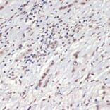 Immunohistochemistry - Anti-JAK2 (phospho Tyr1007 + Tyr1008) Antibody (A11009) - Antibodies.com