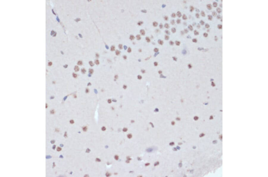Immunohistochemistry - Anti-JAK2 (phospho Tyr1007 + Tyr1008) Antibody (A11009) - Antibodies.com