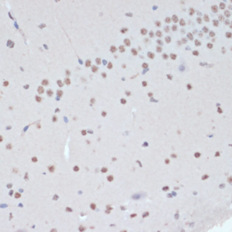 Immunohistochemistry - Anti-JAK2 (phospho Tyr1007 + Tyr1008) Antibody (A11009) - Antibodies.com