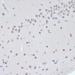 Immunohistochemistry - Anti-JAK2 (phospho Tyr1007 + Tyr1008) Antibody (A11009) - Antibodies.com