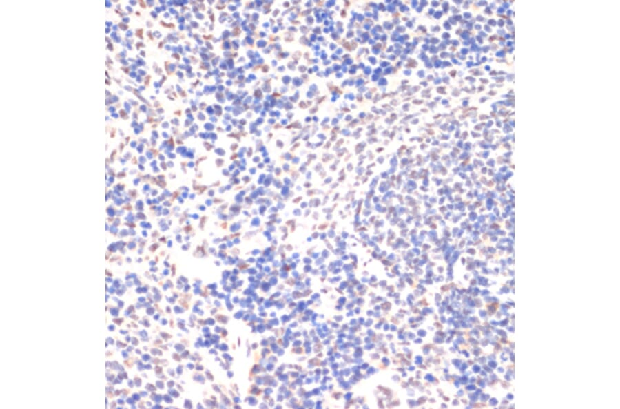 Immunohistochemistry - Anti-JAK2 (phospho Tyr1007 + Tyr1008) Antibody (A11009) - Antibodies.com