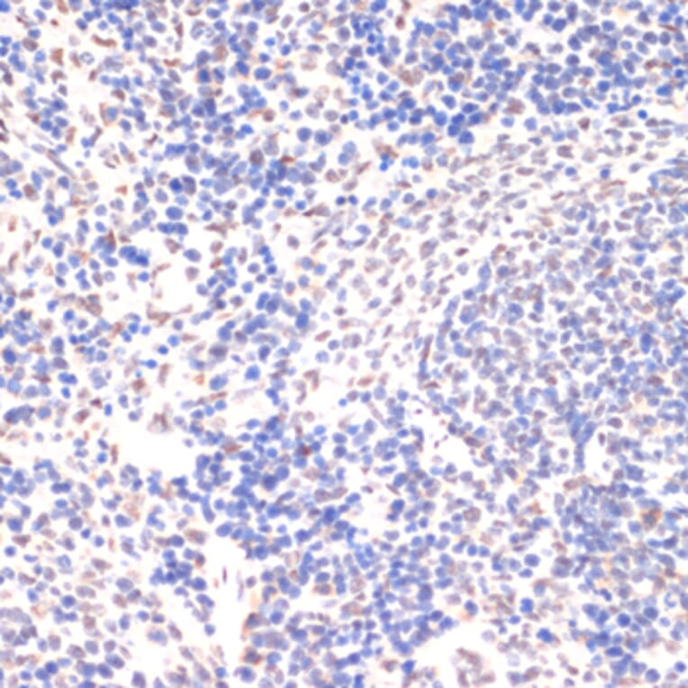 Immunohistochemistry - Anti-JAK2 (phospho Tyr1007 + Tyr1008) Antibody (A11009) - Antibodies.com