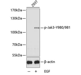 Western Blot - Anti-JAK3 (phospho Tyr980 + Tyr981) Antibody (A11010) - Antibodies.com