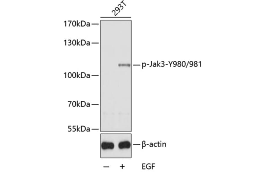 Western Blot - Anti-JAK3 (phospho Tyr980 + Tyr981) Antibody (A11010) - Antibodies.com