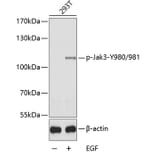 Western Blot - Anti-JAK3 (phospho Tyr980 + Tyr981) Antibody (A11010) - Antibodies.com
