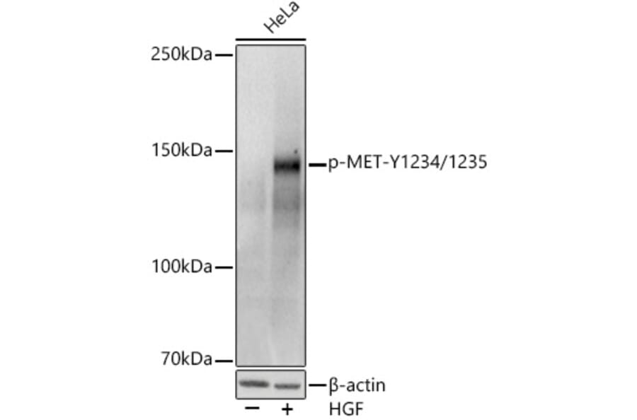 Western Blot - Anti-Met (c-Met) (phospho Tyr1234 + Tyr1235) Antibody (A11011) - Antibodies.com
