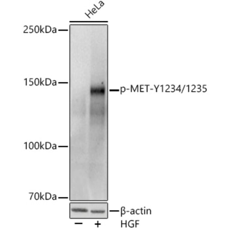 Western Blot - Anti-Met (c-Met) (phospho Tyr1234 + Tyr1235) Antibody (A11011) - Antibodies.com