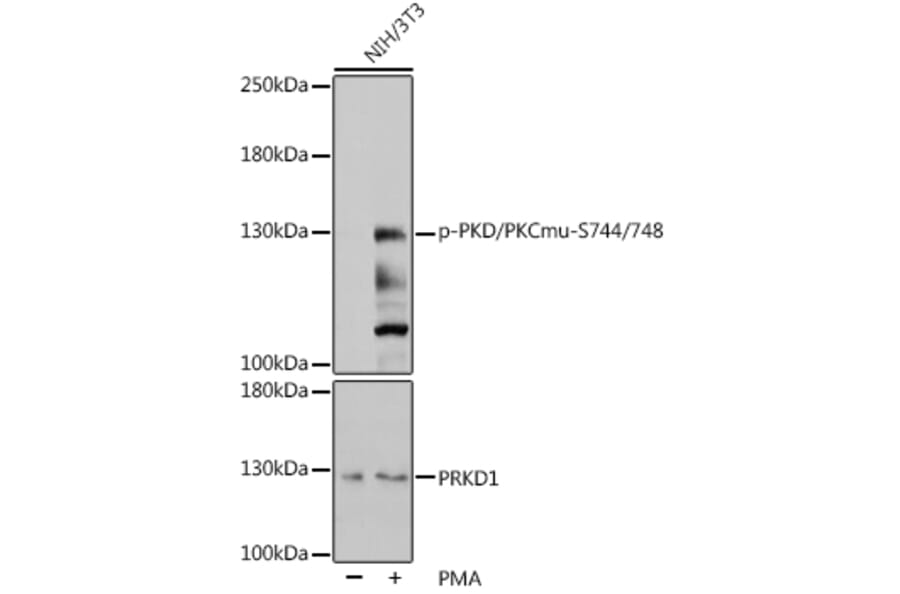 Western Blot - Anti-PKC mu/PKD (phospho Ser744 + Ser748) Antibody (A11012) - Antibodies.com