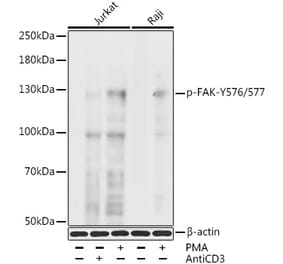 Western Blot - Anti-FAK (phospho Tyr576 + Tyr577) Antibody (A11014) - Antibodies.com