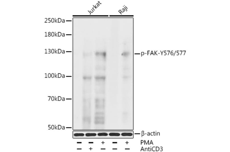 Western Blot - Anti-FAK (phospho Tyr576 + Tyr577) Antibody (A11014) - Antibodies.com