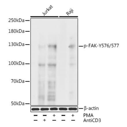 Western Blot - Anti-FAK (phospho Tyr576 + Tyr577) Antibody (A11014) - Antibodies.com