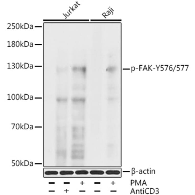 Western Blot - Anti-FAK (phospho Tyr576 + Tyr577) Antibody (A11014) - Antibodies.com