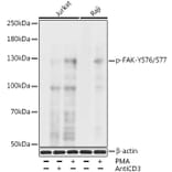 Western Blot - Anti-FAK (phospho Tyr576 + Tyr577) Antibody (A11014) - Antibodies.com