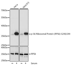 Western Blot - Anti-RPS6 (phospho Ser240 + Ser244) Antibody (A11015) - Antibodies.com