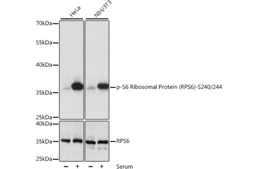 Western Blot - Anti-RPS6 (phospho Ser240 + Ser244) Antibody (A11015) - Antibodies.com