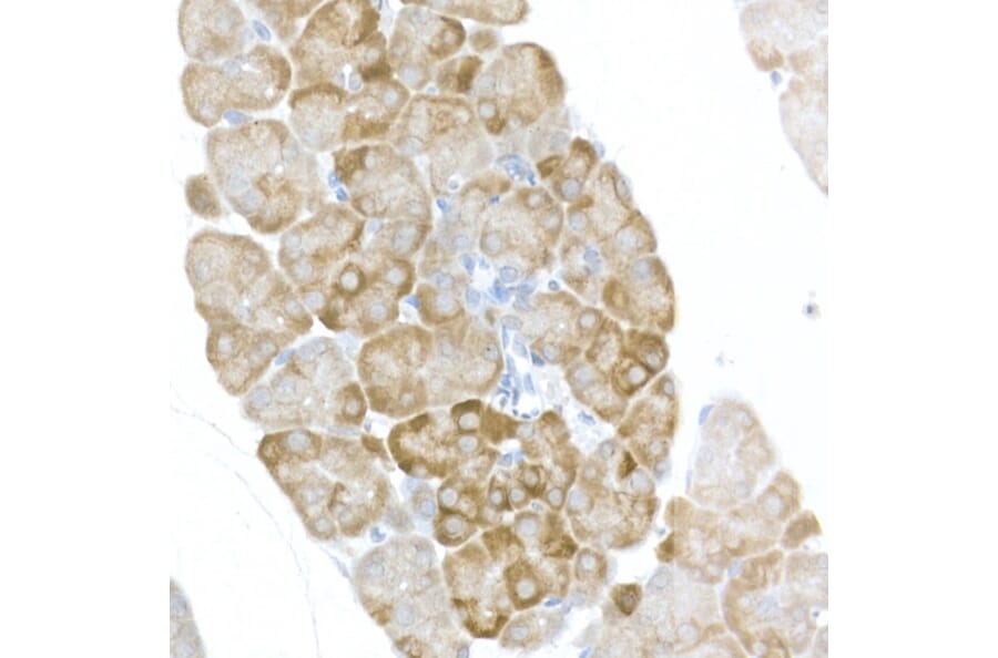 Immunohistochemistry - Anti-RPS6 (phospho Ser240 + Ser244) Antibody (A11015) - Antibodies.com