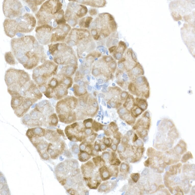 Immunohistochemistry - Anti-RPS6 (phospho Ser240 + Ser244) Antibody (A11015) - Antibodies.com