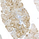 Immunohistochemistry - Anti-RPS6 (phospho Ser240 + Ser244) Antibody (A11015) - Antibodies.com