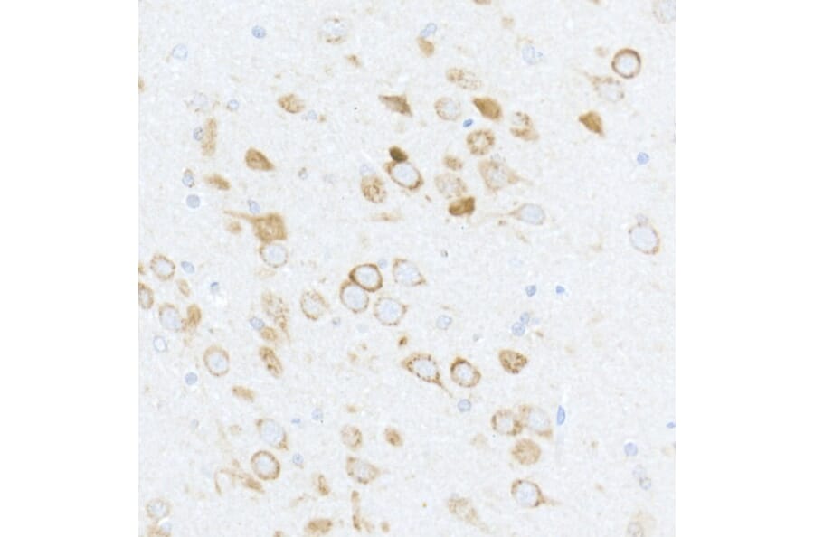 Immunohistochemistry - Anti-RPS6 (phospho Ser240 + Ser244) Antibody (A11015) - Antibodies.com