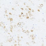 Immunohistochemistry - Anti-RPS6 (phospho Ser240 + Ser244) Antibody (A11015) - Antibodies.com