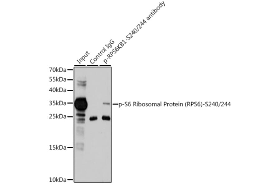 Western Blot - Anti-RPS6 (phospho Ser240 + Ser244) Antibody (A11015) - Antibodies.com