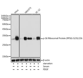 Western Blot - Anti-RPS6 (phospho Ser235 + Ser236) Antibody (A11016) - Antibodies.com