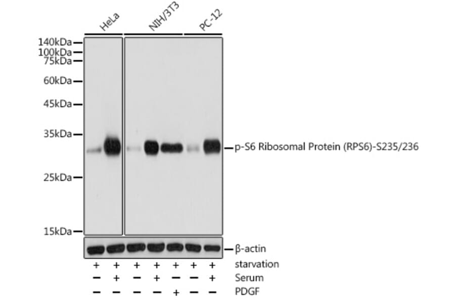 Western Blot - Anti-RPS6 (phospho Ser235 + Ser236) Antibody (A11016) - Antibodies.com