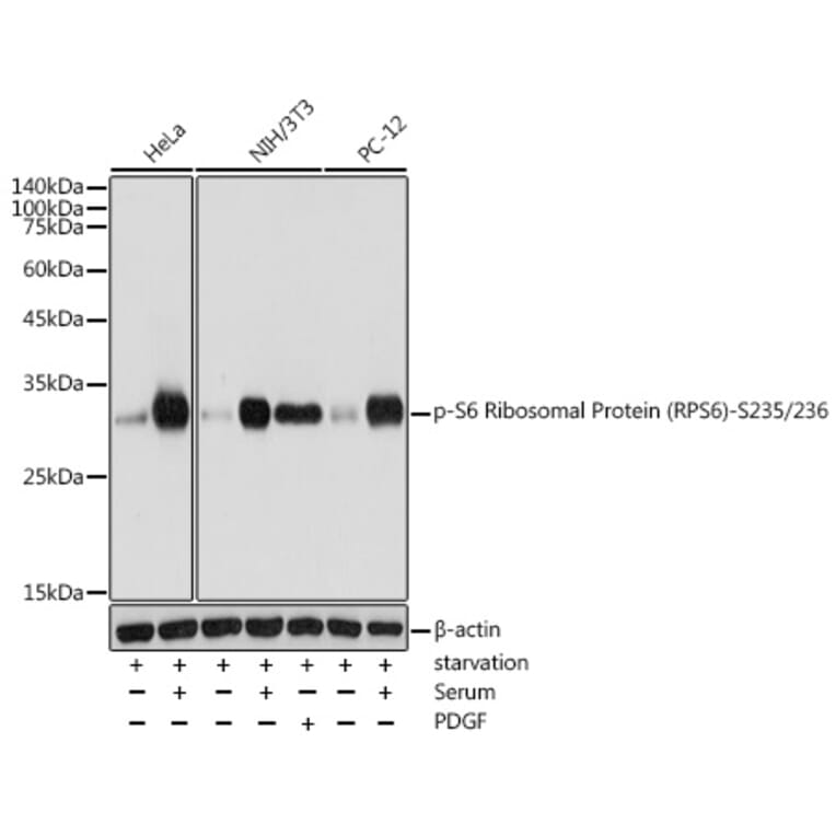 Western Blot - Anti-RPS6 (phospho Ser235 + Ser236) Antibody (A11016) - Antibodies.com