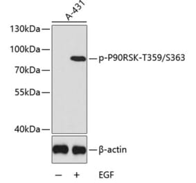 Western Blot - Anti-RSK1 p90 (phospho Thr359 + Ser363) Antibody (A11017) - Antibodies.com