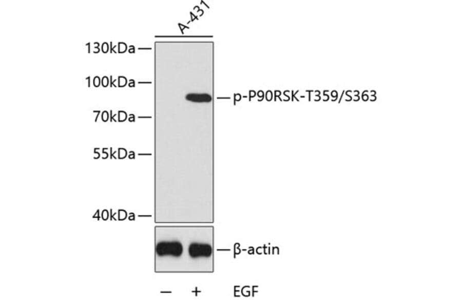 Western Blot - Anti-RSK1 p90 (phospho Thr359 + Ser363) Antibody (A11017) - Antibodies.com