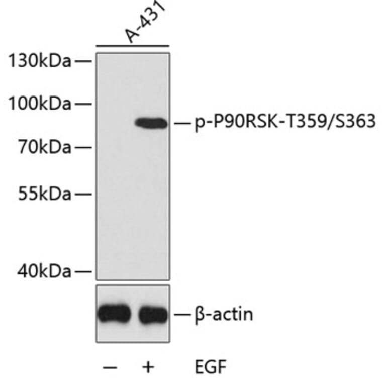 Western Blot - Anti-RSK1 p90 (phospho Thr359 + Ser363) Antibody (A11017) - Antibodies.com