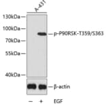 Western Blot - Anti-RSK1 p90 (phospho Thr359 + Ser363) Antibody (A11017) - Antibodies.com
