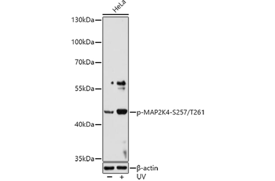 Western Blot - Anti-MEK4/MKK4 (phospho Ser257 + Thr261) Antibody (A11019) - Antibodies.com