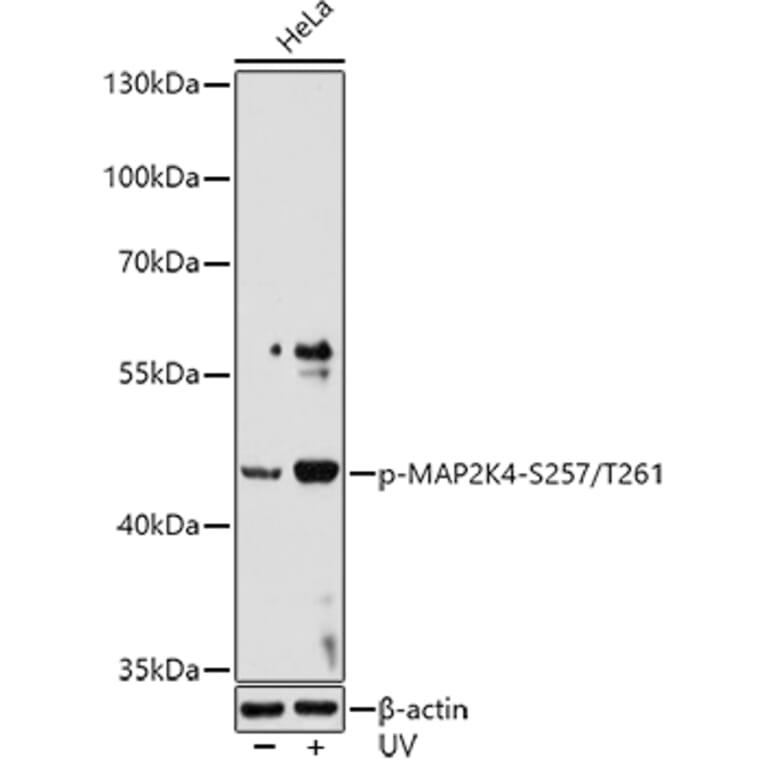 Western Blot - Anti-MEK4/MKK4 (phospho Ser257 + Thr261) Antibody (A11019) - Antibodies.com