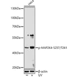 Western Blot - Anti-MEK4/MKK4 (phospho Ser257 + Thr261) Antibody (A11019) - Antibodies.com