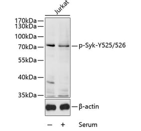 Western Blot - Anti-Syk (phospho Tyr525 + Tyr526) Antibody (A11020) - Antibodies.com