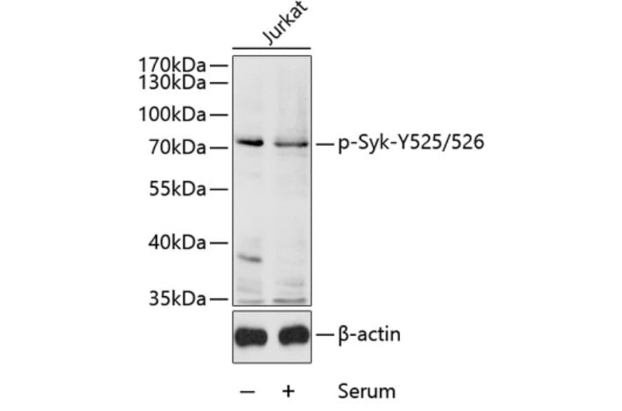 Western Blot - Anti-Syk (phospho Tyr525 + Tyr526) Antibody (A11020) - Antibodies.com