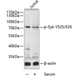 Western Blot - Anti-Syk (phospho Tyr525 + Tyr526) Antibody (A11020) - Antibodies.com