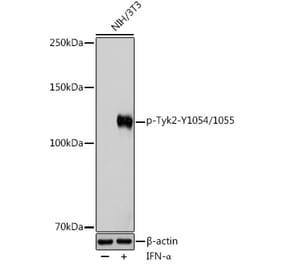 Western Blot - Anti-TYK2 (phospho Tyr1054 + Tyr1055) Antibody (A11021) - Antibodies.com