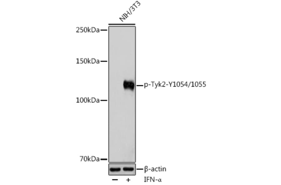 Western Blot - Anti-TYK2 (phospho Tyr1054 + Tyr1055) Antibody (A11021) - Antibodies.com