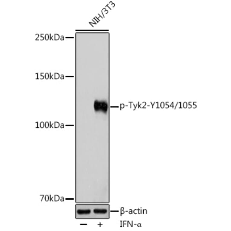 Western Blot - Anti-TYK2 (phospho Tyr1054 + Tyr1055) Antibody (A11021) - Antibodies.com