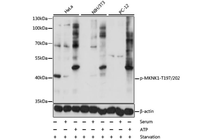 Western Blot - Anti-MKNK1 (phospho T197 + T202) Antibody (AP0544) - Antibodies.com