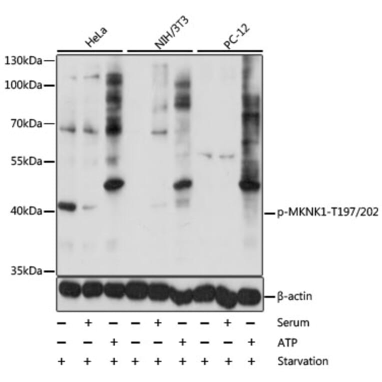 Western Blot - Anti-MKNK1 (phospho T197 + T202) Antibody (AP0544) - Antibodies.com