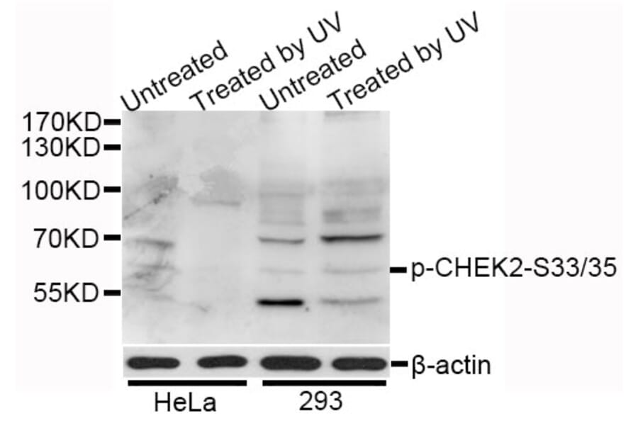 Western Blot - Anti-CHEK2 (phospho S33 + S35) Antibody (AP0545) - Antibodies.com