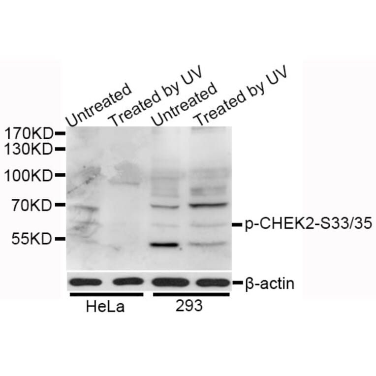 Western Blot - Anti-CHEK2 (phospho S33 + S35) Antibody (AP0545) - Antibodies.com